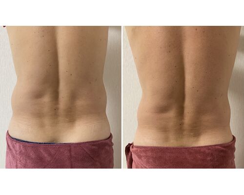 85ADBCC3-BEAE-4158-BDF0-82E0EAA68F02